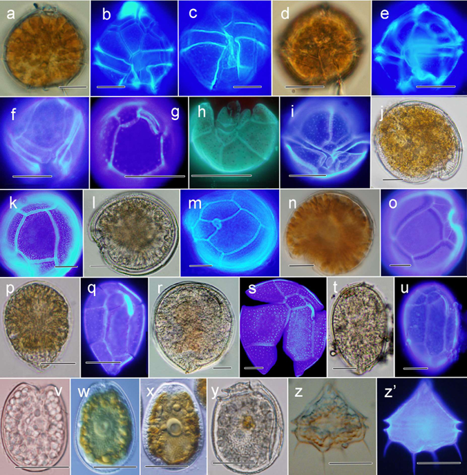 Microscopic imagery of potentially harmful algal species.